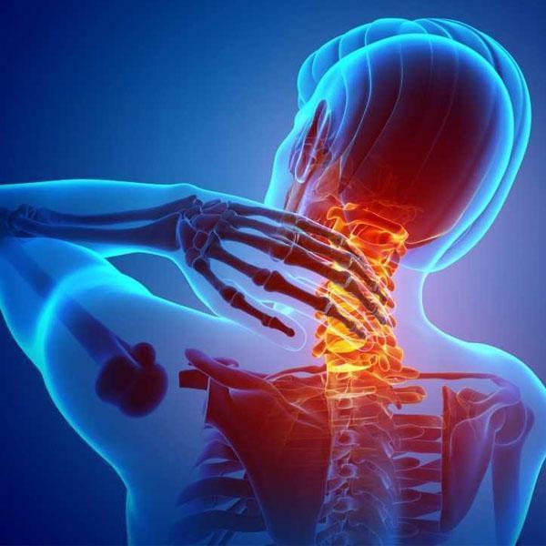 Pinched Nerves – Gastonia Chiropractor